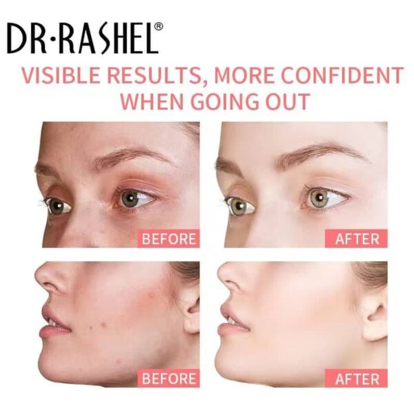 Dr. Rashel Whitening Complex Pink Mineral Clay Stick Mask - Image 3